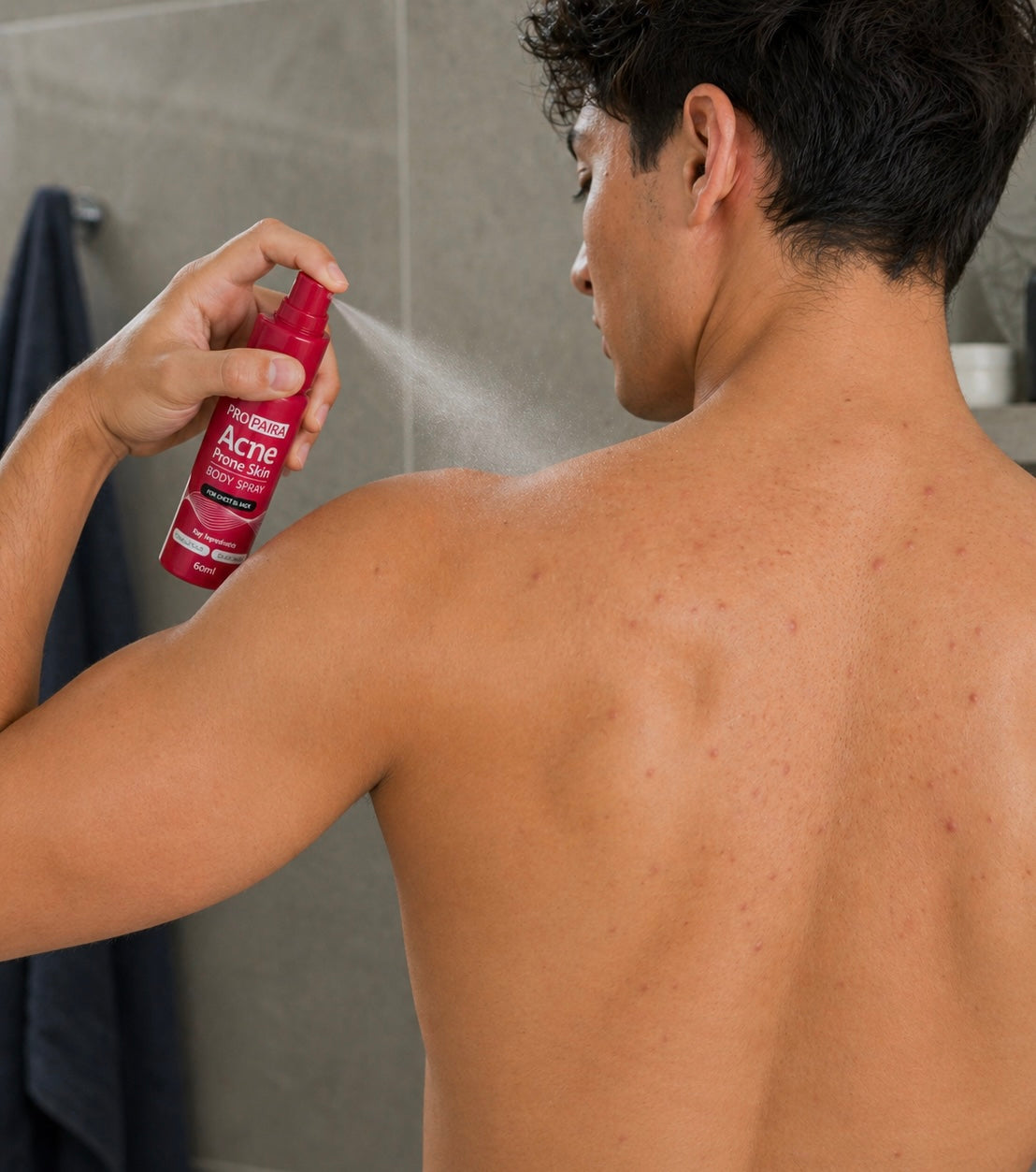 Acne Body Spray for Chest and Back 60ml by Propaira - packaging and details - spot treatment